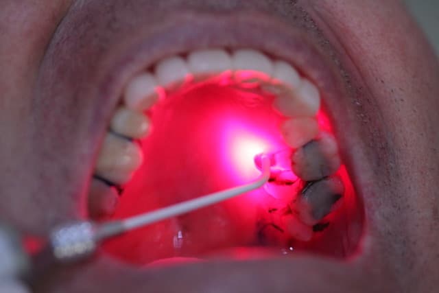 Helbo photodynamic therapy